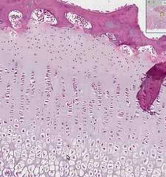 endochondral ossification histology