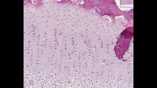 Shotgun Histology Endochondral Ossification