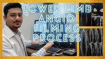 CT SCAN LOWER LIMB ANGIOGRAPHY FILMING PROCESS/TECHNIQUE | #angiography #radiologytechnologist