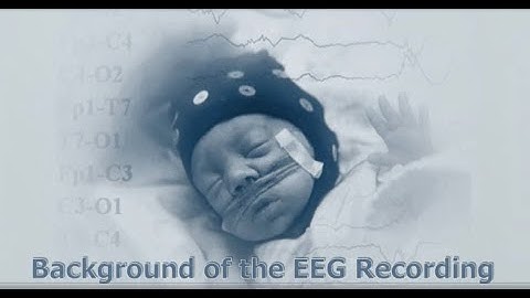 Preterm infant EEG. Recording and analysis with multichannel&multimodal methodology