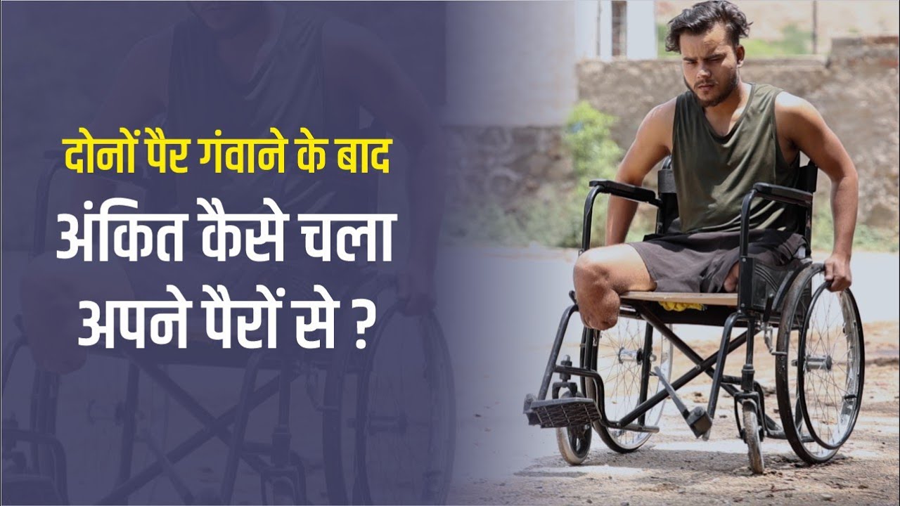 अंकित की निराशा बदली खुशियों में। Artificial Limb | Narayan Seva Sansthan | NGO | | Specially Abled