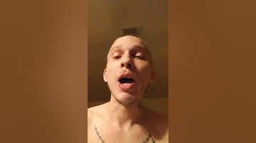 Xbox one error 102 , 101, 106 fix