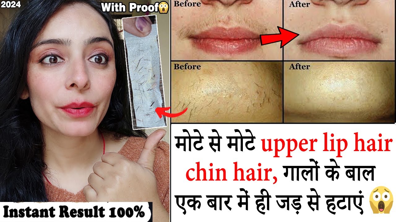 (New) Face Hair Removal For Women at Home Upper Lip Hair Removal