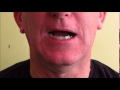 Swallowing Exercise follow-along video(Aud.Tewfiq Siliman Herini - Erbil-Kurdistan)) tewfiqsiliman@yahoo.com 009647504485973