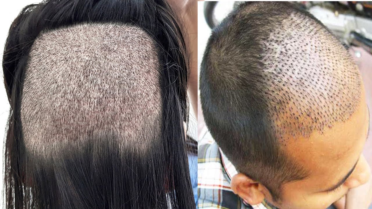 fix hair problems Put Salt In Your Shampoo Will Solves One Of The Biggest Hair Problems Hair