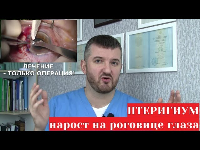 Птеригиум - нарост на роговице глаза (причины, лечение, чем опасно)