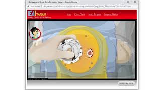 EdHeads Deep Brain Stimulation Gameplay screenshot 1