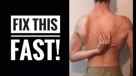 How To Fix Scapular Winging (STEP BY STEP!)