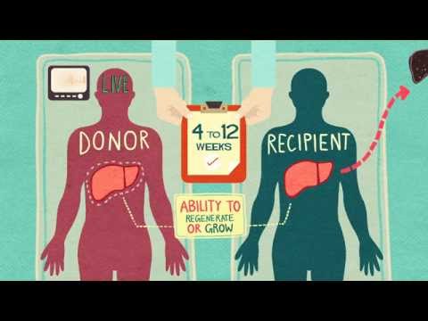 Video: Kroppsmassaindex Och Resultat Hos Mottagare Av Njurtransplantationer: En Systematisk översyn Och Metaanalys