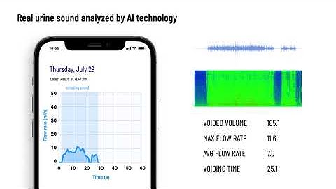 proudP: Low Qmax Uroflow Curve