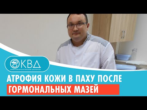 😐 Атрофия кожи в паху после гормональных мазей. Клинический случай №292