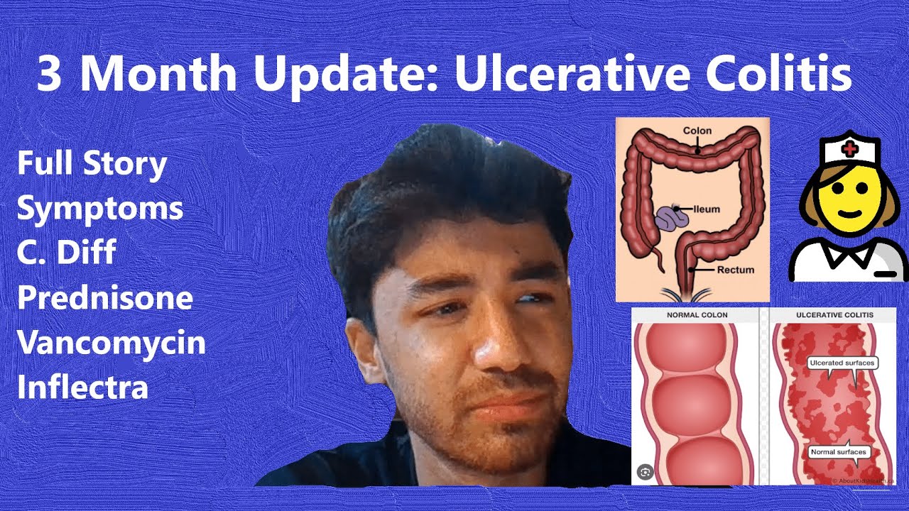 Opening Up About my Ulcerative Colitis 3 Month Update, C. Diff