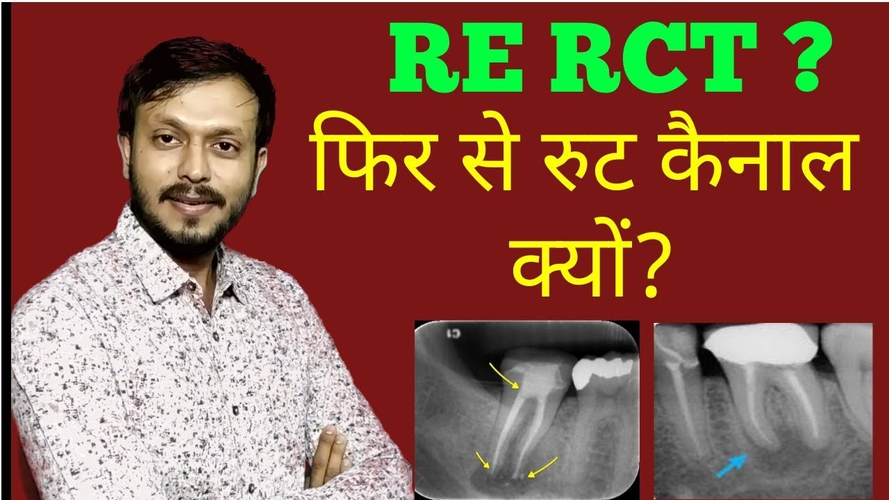 Doctor Rx Kyo Likhte Hai What Is Meaning Rx In Medicine Doctor Rx Kyo Likhte Hai What Is Meaning Rx In Medicine