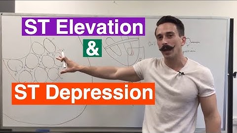 ST Elevation and ST Depression EXPLAINED