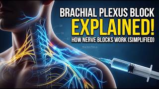 Brachial Plexus Block Explained | How Nerve Blocks Work (Simplified)