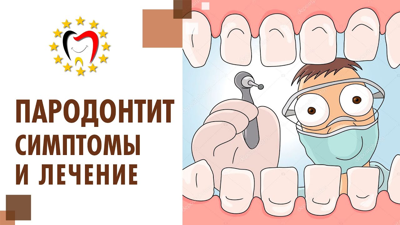 Пародонтит: что это такое, причины, симптомы, как лечить? 🤔 Что такое ...