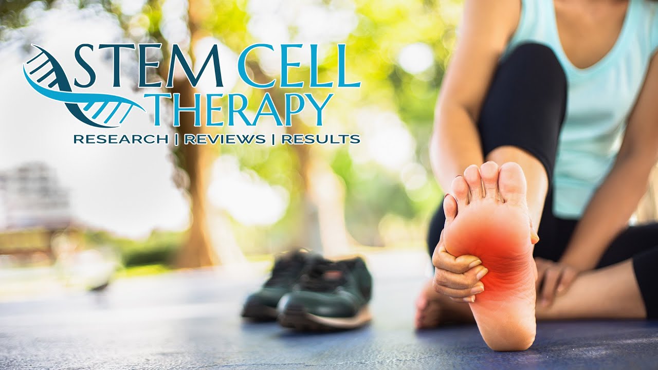 Stem Cell Therapy For Neuropathy Clinical Trials Stem Cell Therapy for Neuropathy | SCT Reviews