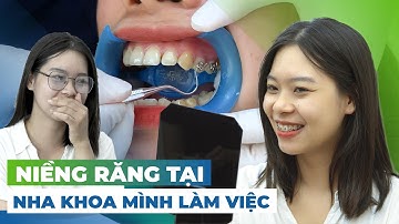 Vì Sao Mình Lại Quyết Định Đi NIỀNG RĂNG?