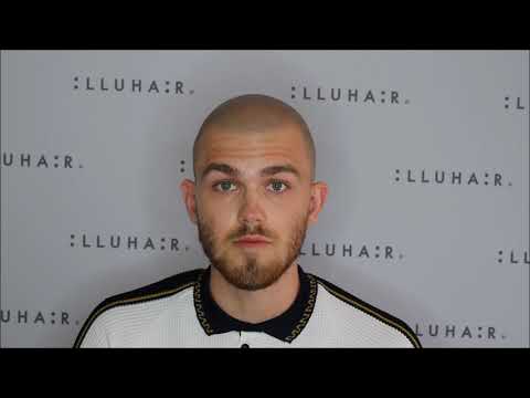 Video: Behandling Af Alopecia Med Lægemidler