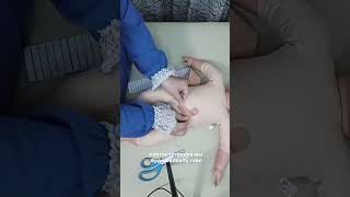 Рубец после КС. Как работать с рубцом и восстановиться после родов? Взгляд специалиста по движению.