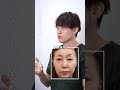 クマ取り▶70代女性(切らずに改善できる?)