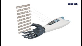 Ottobock Myo Plus pattern recognition: The AI control for myoelectric arm prostheses | Ottobock