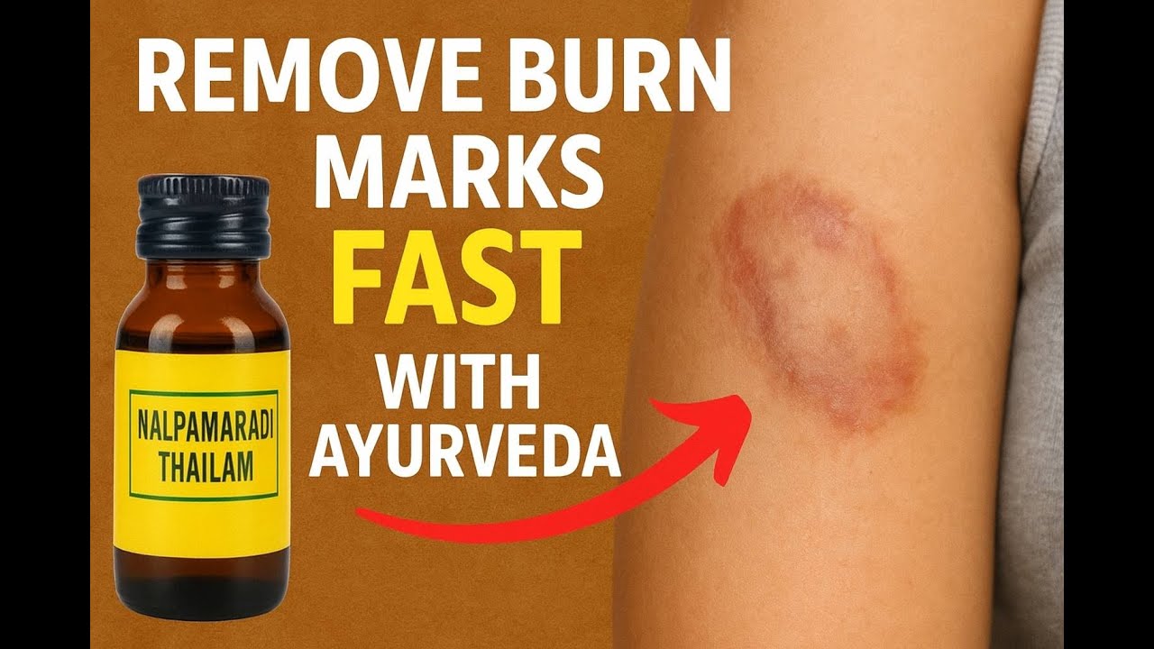 Dr Xavier Reveals Ayurvedic Oil Secrets for Fading Burn Scars