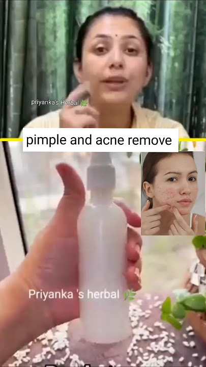 how to remove pimple and acne by upasana vohra #toner#pimpleproblem#acnetreatment#rice#beautytips