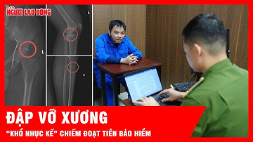 Khởi tố cựu cán bộ y tế cầm đầu đường dây làm giả thương tích để chiếm đoạt tiền bảo hiểm | Tin tức
