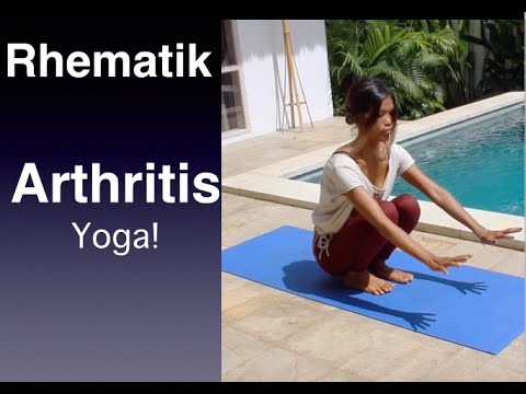 Video: Artritis Ringan: Sama Dengan Artritis Rheumatoid Sederhana Atau Parah?