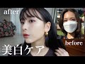 【美白ケア】ホームケアで私が白くなった方法!私の美白習慣大公開❤️