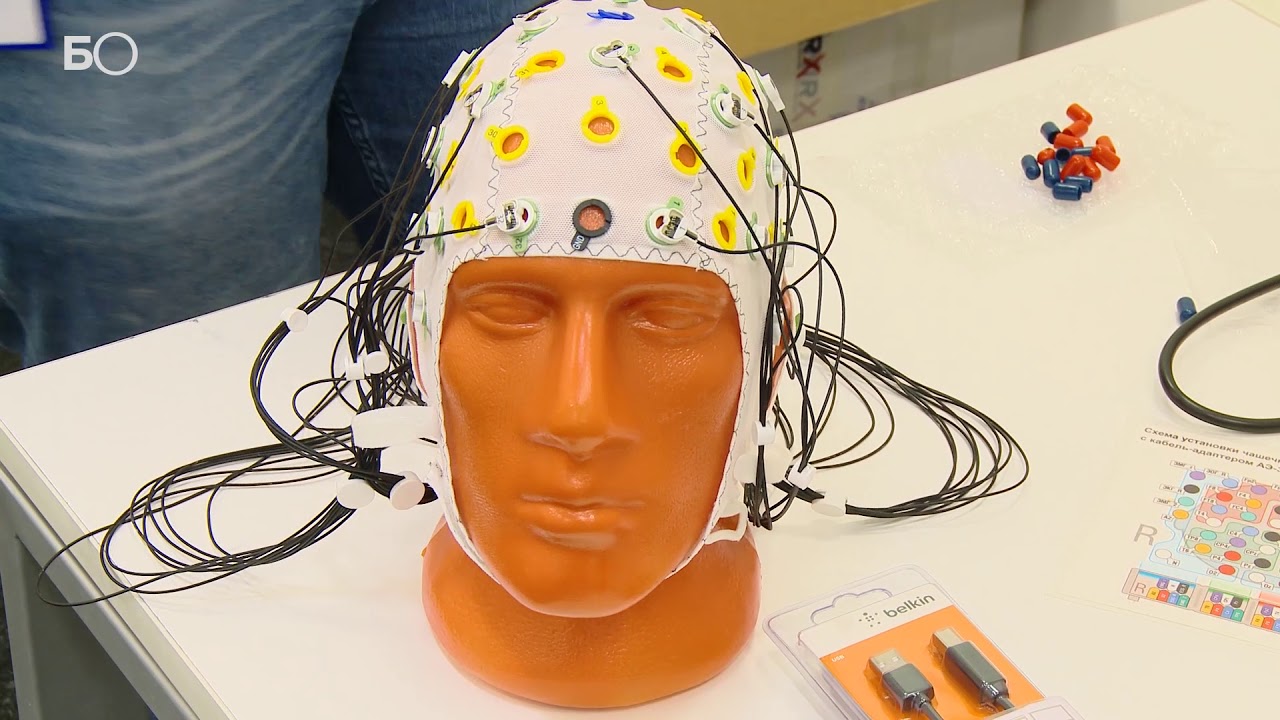 Ученые Университета Иннополис научились предсказывать приступы эпилепсии