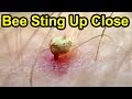 Honey Bee Stinger Super Close Up 