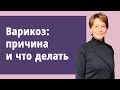 Варикоз: причина и что делать.