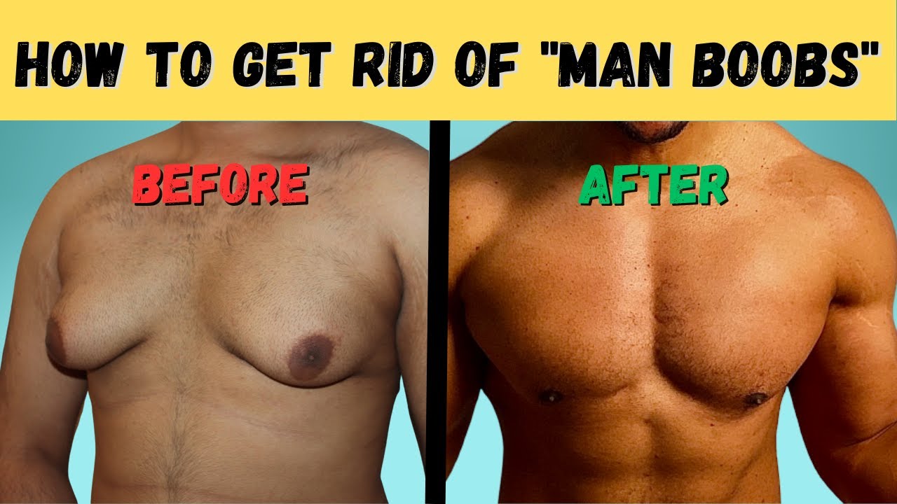 How to get rid of Man Boobs and get a more Muscular Chest