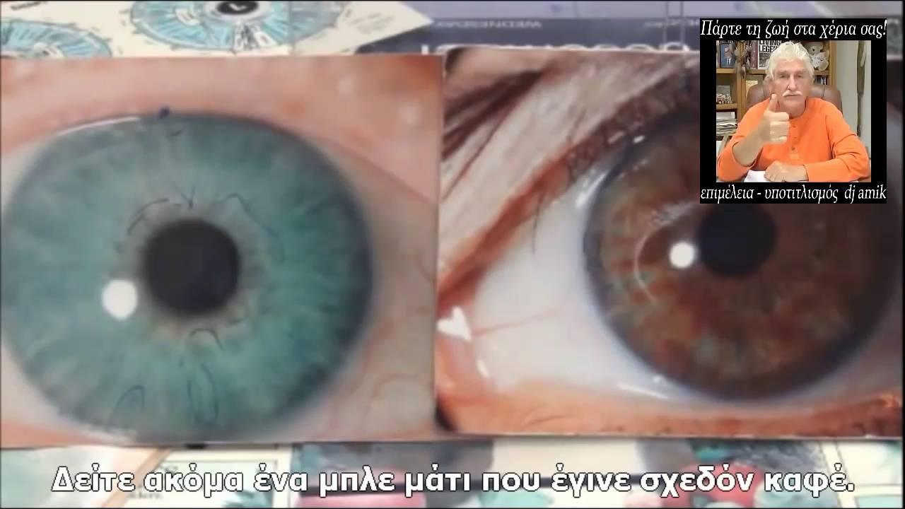 DR. ROBERT MORSE Ιριδολογία (με υπότιτλους) YouTube