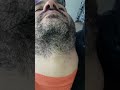 Depilação  de barba