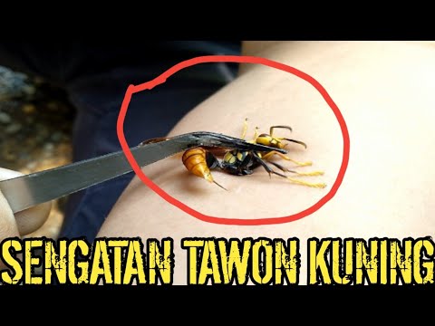 SENGATAN TAWON KUNING  EFEK SENGATAN TAWON  DAN CARA 