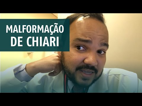 Malformação de Chiari: Causas, sintomas e tratamentos