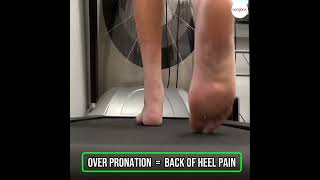 Overpronation Causes Back Of Heel Pain