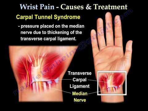 wrist pain,causes and treatment  PART I. Everything You Need To Know - Dr. Nabil Ebraheim