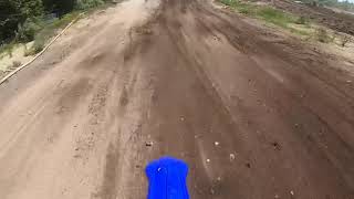 MX101