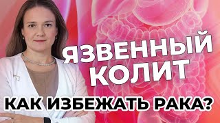 Язвенный колит: как избежать рака?