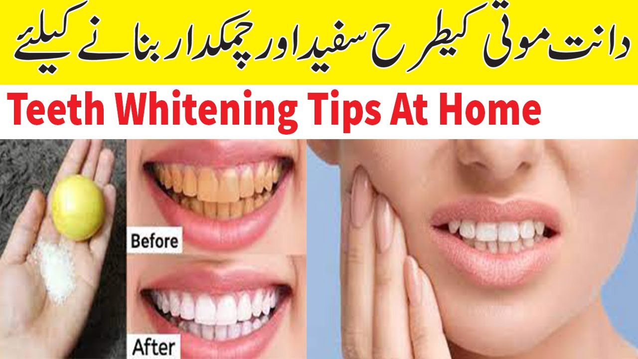 Quick and Easy Teeth Whitening Tips At Home In Urdu Teeth Whitening