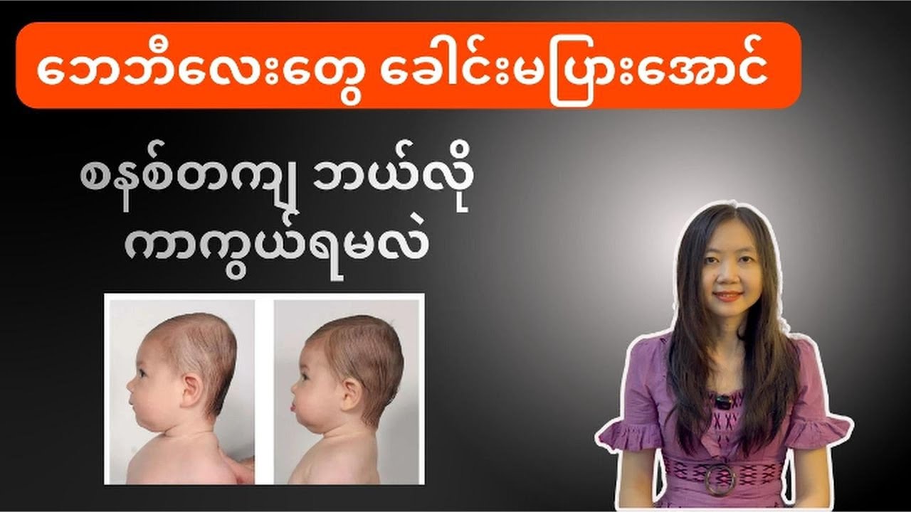 ဘေဘီလေးတွေ ခေါင်းမပြားအောင် စနစ်တကျဘယ်လိုကာကွယ်မလဲ? | Flat  Head | By Dr. Lwin