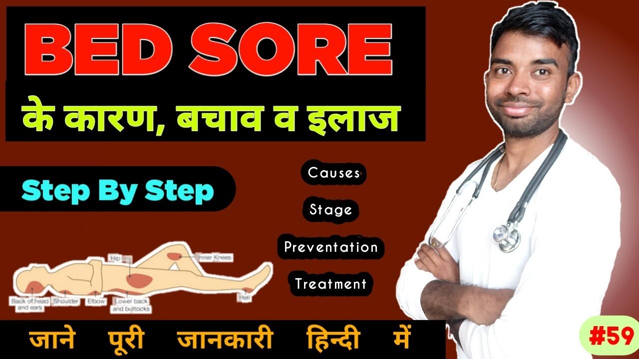 bed sores treatment in hindi stage, causes, prevention pressure ulcers decubitus ulcers