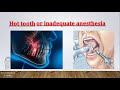 Hot tooth - Differentiate and Treat