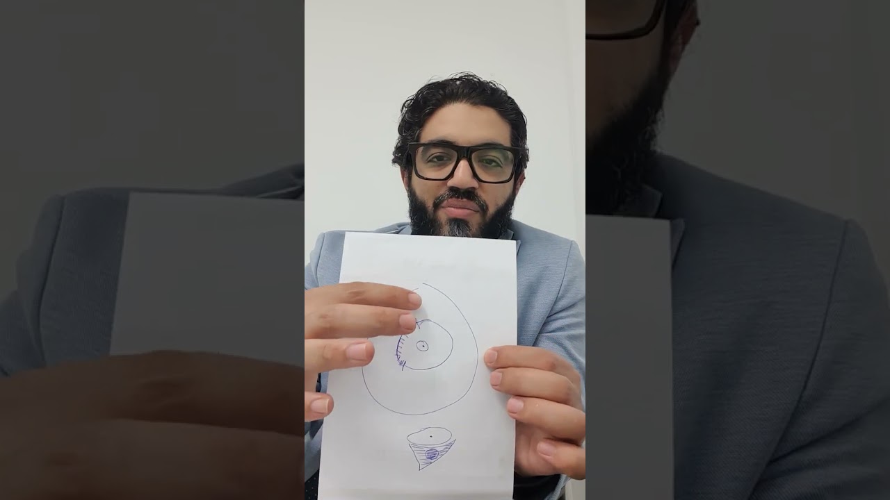 تمدد القنوات اللبنيه benign  ductal dilatation , Major duct Excision