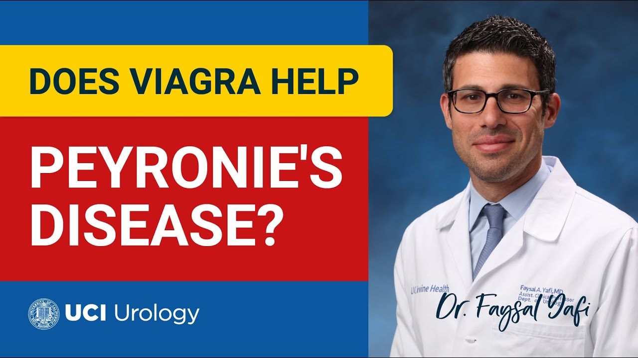Does Viagra help Peyronie's disease? | UC Irvine Health ...