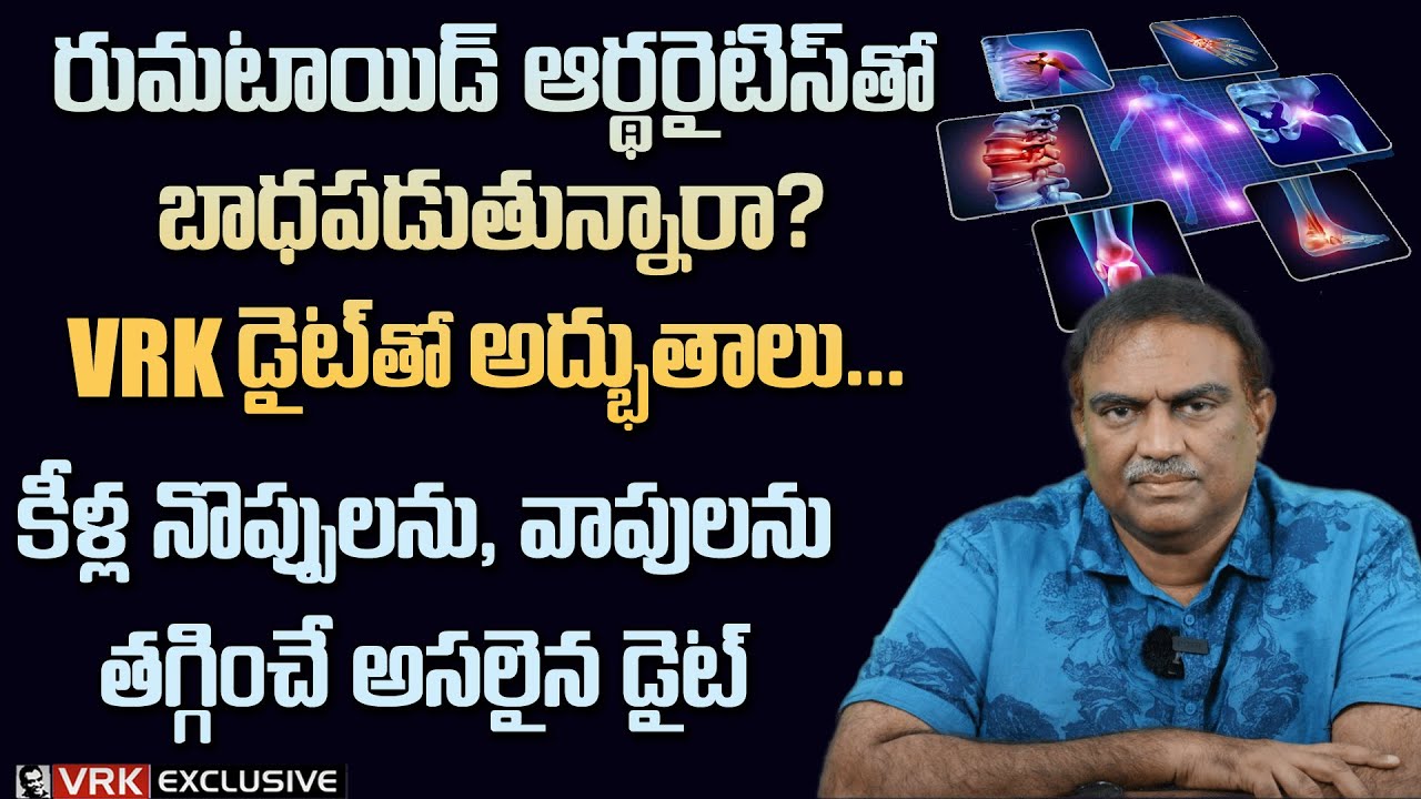 Rheumatoid Arthritis Treatment in VRK Diet | Best Diet For RA | Veeramachaneni | Keella Noppulu